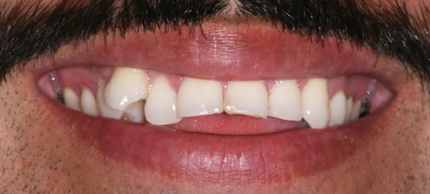 Before Treatment Case 3