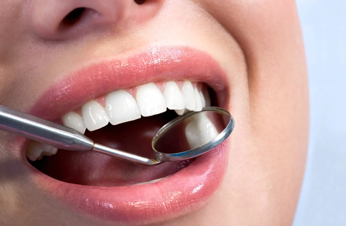Cosmetic Dental Treatment